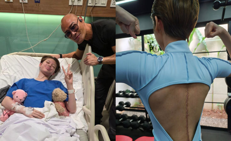 Nada Tarina Tunjukkan Bekas Operasi Skoliosis di Punggungnya, Anak Deddy Corbuzier Ungkap Perasaannya